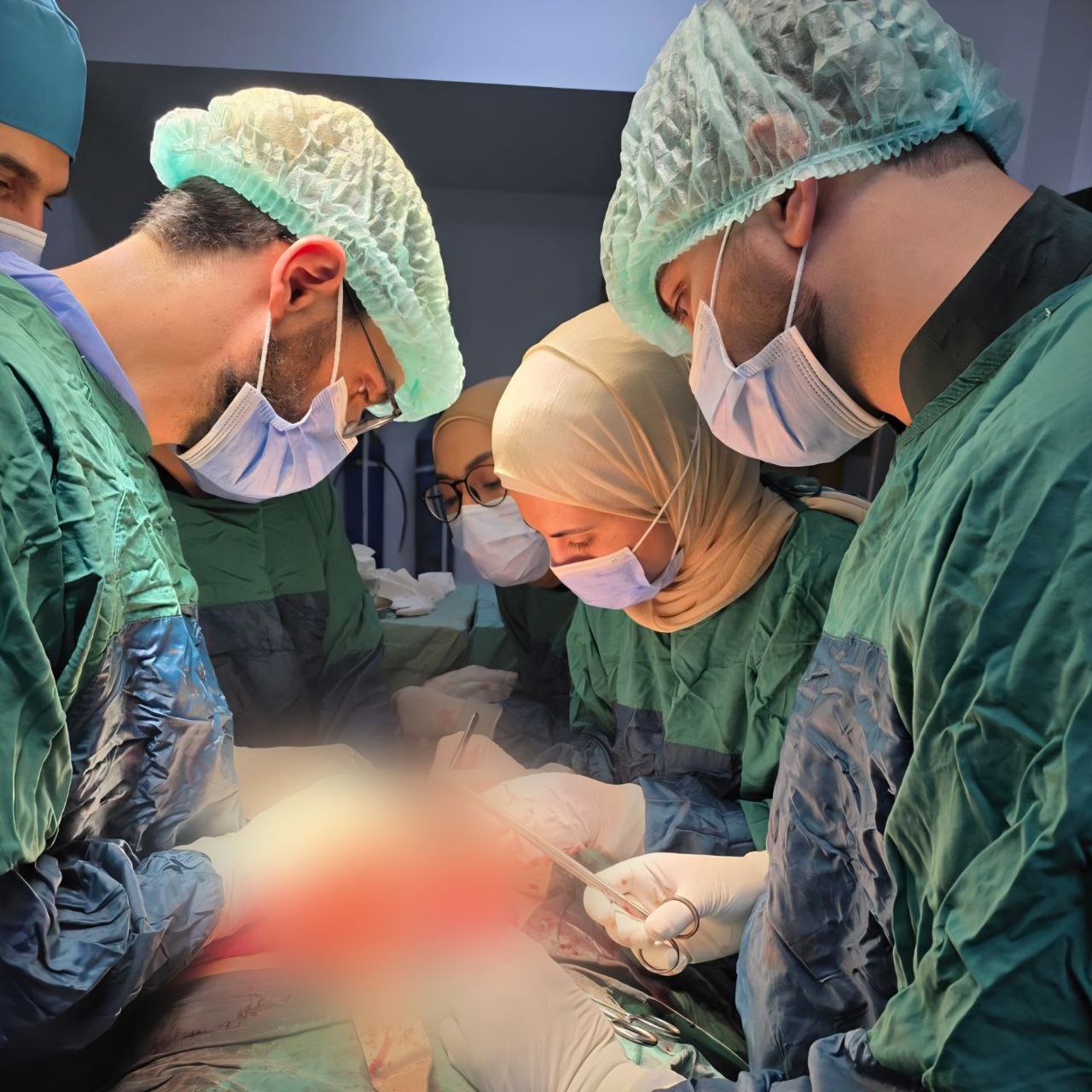 إنجاز طبي في مشفى التل الوطني.. نجاح عملية استئصال ورم في الكولون لمريض فقر دم شديد